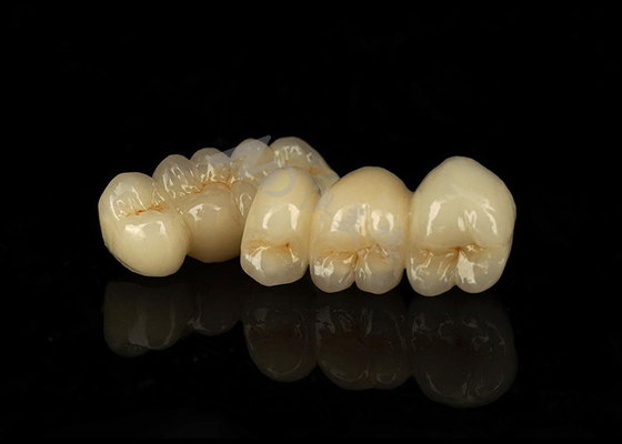 Buon prezzo Corona di zirconia solida resistente alle macchie che combina eccellente biocompatibilità in linea