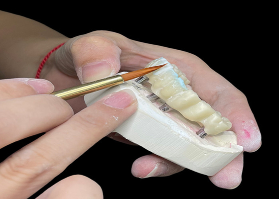 Buon prezzo Impianto dentale lucidato personalizzabile ponte corona duraturo per un'igiene facile in linea