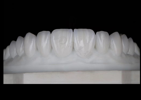 Buon prezzo Traslucidità Corone di zirconia naturale estetica eccellente biocompatibilità e resistenza in linea