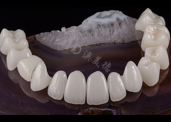 Buon prezzo Dente traslucido Dente massiccio Corona di zirconio Estetica naturale Resistenza agli frantumi in linea