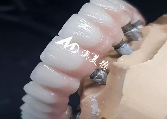 Buon prezzo Esclusivo impianto dentale ad alte prestazioni Crown Bridge Disponibile in varie dimensioni in linea