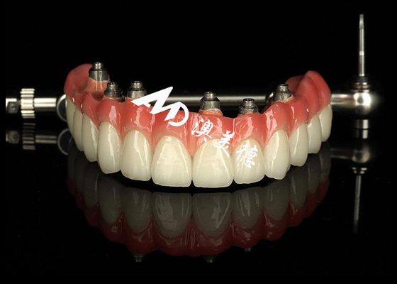 Buon prezzo Dentistiche personalizzate protesi a supporto di impianti dentali Crown Bridge Per la manutenzione dei denti mancanti in linea