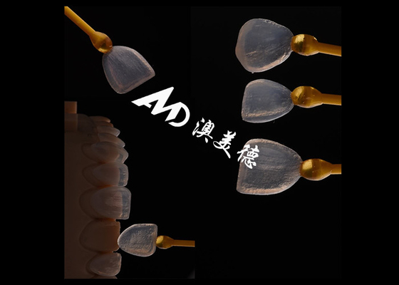 Buon prezzo Forza Veneer EMAX Aspetto naturale Ottima adatta a restauri estetici in linea