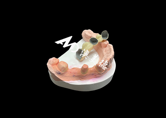 Buon prezzo Corona PFM di precisione in ceramica resistente alla corrosione con legante metallico in linea