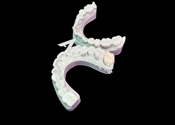 Buon prezzo Precise Fit Circonia Dental Crown Estetico Colore naturale Eccellente Biocompatibilità in linea