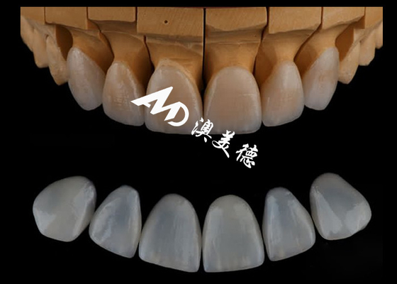 Buon prezzo Finestre dentistiche di Emax/porcellana per odontoiatria cosmetica altamente precise e personalizzate in linea