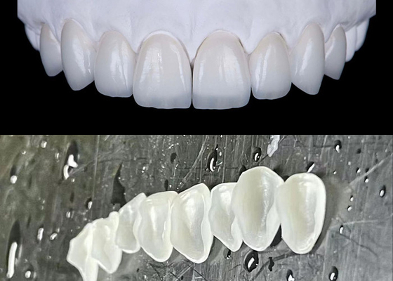 Buon prezzo IPS emax Veneer di porcellana da stampa per ottenere un sorriso naturale e radioso in linea