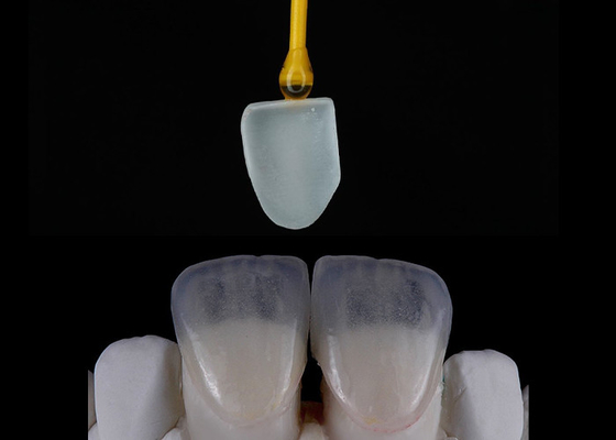 Buon prezzo Restituzione dentale su misura EMAX Veneers Belle allineate Impressione digitale in linea