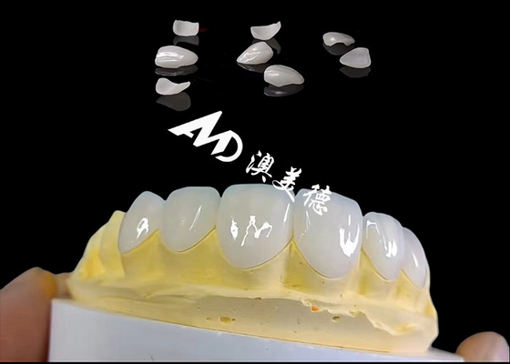 Buon prezzo Translucency IPS Emax Veneers, Preparazione minima Emax Dental Veneers in linea