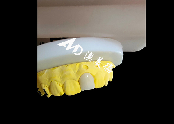 Buon prezzo Corone dentale di zirconia dall'aspetto naturale e estetico Restauro dei denti in perfetta forma in linea