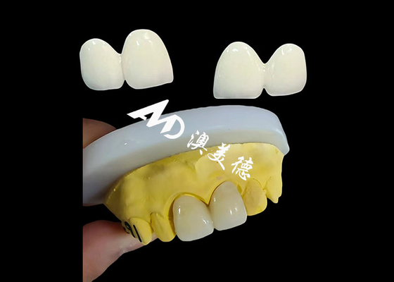 Buon prezzo Corona dentale di zirconia personalizzata con cappuccio per denti di precisione dal laboratorio dentale cinese in linea