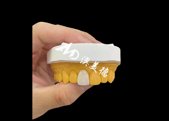 Buon prezzo Incisivo anteriore Zirconia Corona dentale Naturale Alta resistenza all'usura in linea