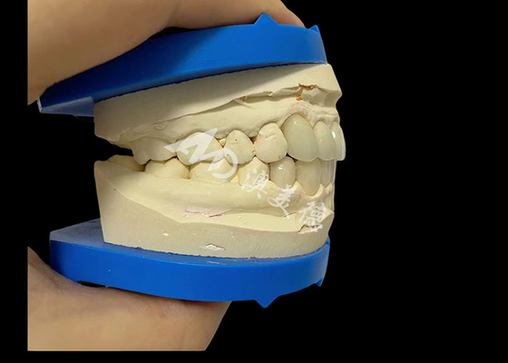 Buon prezzo Forza imbattibile Dental Zirconia Dentla Crown per sorrisi naturali in linea
