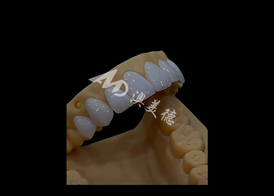 Buon prezzo Protesi dentale Circonia Corona dentale Precise Fit Estetica Per denti ad arco completo in linea