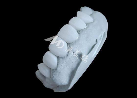 Buon prezzo Corona dentale in zirconia che offre una forza imbattibile e una naturale morbidezza e traslucidità naturale. in linea