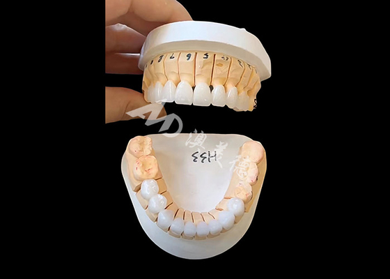 Buon prezzo Corona dentale circonia di traslucidità migliorata per restauri fissi a unità singola / multi in linea