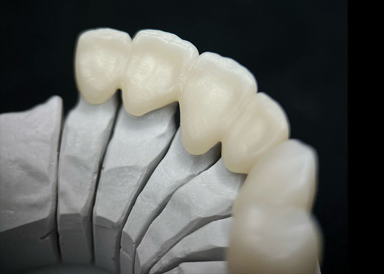 Buon prezzo Corona dentale di zirconia massello che ombra eccezionale resistenza ed estetica naturale in linea