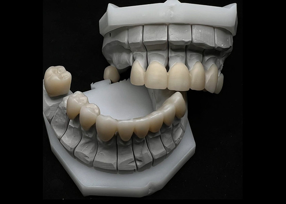 Buon prezzo Resistenza al frantumamento della corona dentale di zirconia per denti singoli o multipli in linea