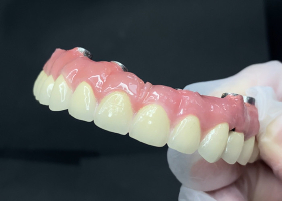 Buon prezzo Impianti dentali durevoli con abuto in titanio facile da pulire e corona in zirconia in linea