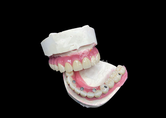 Buon prezzo Impianto dentale circonico, ponte corona, tutti a 6 per la sostituzione dei denti mancanti. in linea