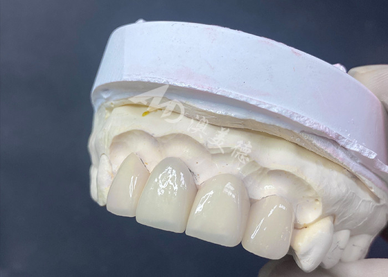 Buon prezzo Finestre dentistiche di precisione per un sorriso impeccabile in linea