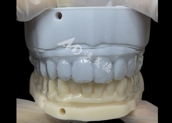 Buon prezzo Ritenitore ortodontico Ritenitore Essix Correzione semplice e versatile in linea