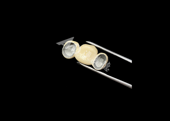 Buon prezzo Porcellana adatta alla misura, fusa a corona metallica, con eccellente biocompatibilità in linea