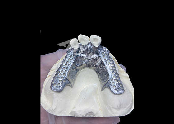 Buon prezzo Easy Fit Custom Cast Parziale Protesi Stabile e naturale struttura per risultati rapidi in linea