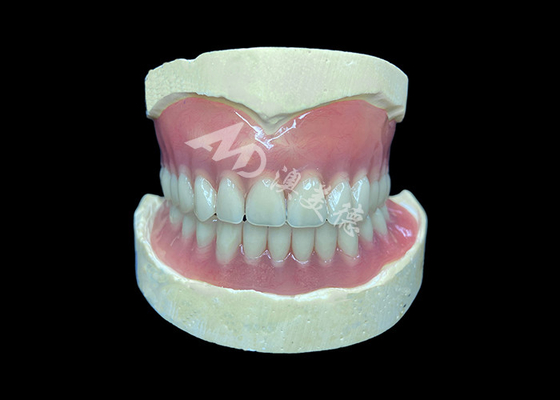 Buon prezzo Denti parziali cast su misura, facili da pulire, ideali per ripristinare la capacità di masticare e il sorriso in linea