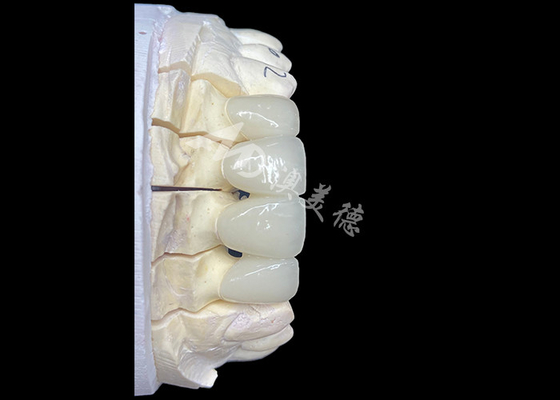 Buon prezzo Il ponte della corona in ceramica circonia dall'aspetto naturale offre precisione ed estetica combinate in linea