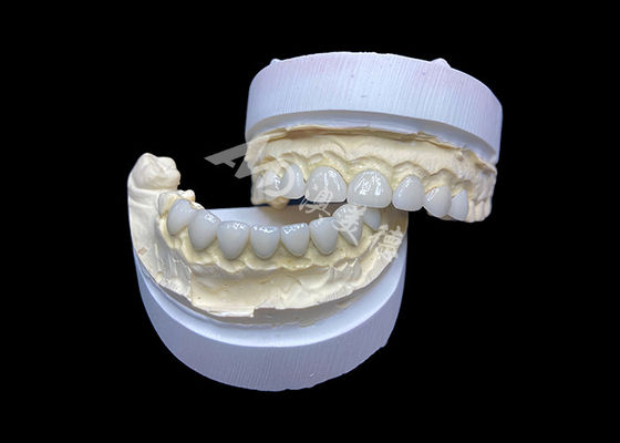 Buon prezzo Personalizzazione Veneer in vetro ultra sottile in ceramica ad alta traslucidità in linea