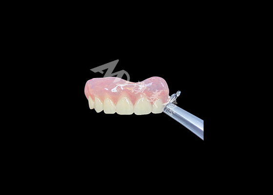 Buon prezzo Dentiera parziale facile da montare ripristina la capacità di masticare e parlare in linea