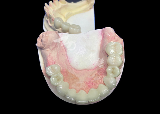 Buon prezzo Corona di zirconia di lava dall'aspetto naturale con una durabilità senza pari eccellente biocompatibilità in linea
