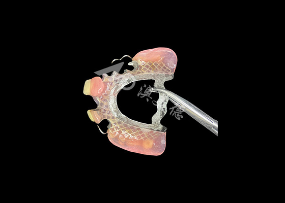 Buon prezzo Protesi parziali cast per la precisione, la durata e il comfort nella sostituzione parziale dei denti in linea