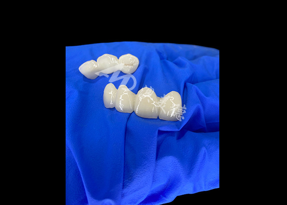 Buon prezzo Wieland Zenostar Ceramic Crown Bridge Alta precisione per restauri durevoli e naturali in linea