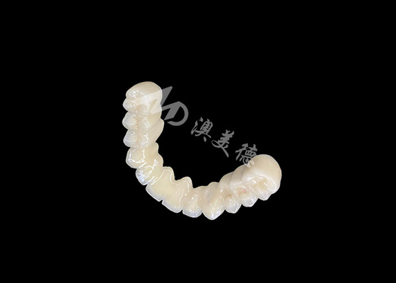 Buon prezzo Collegamento duraturo PFM Dental Crown Bridge con eccellente biocompatibilità in linea