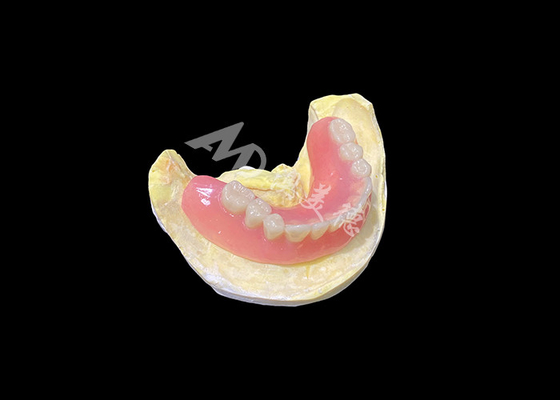 Buon prezzo Protesi dentali in acrilico completo Denti rimovibili personalizzate Facile da pulire e durevole in linea
