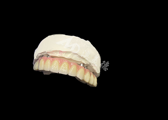 Buon prezzo Protesi protesi stabilità comfort e sorriso naturale in linea