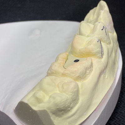 Buon prezzo Reinforce Your Restoration with Lock Pink Post Core Technology in linea