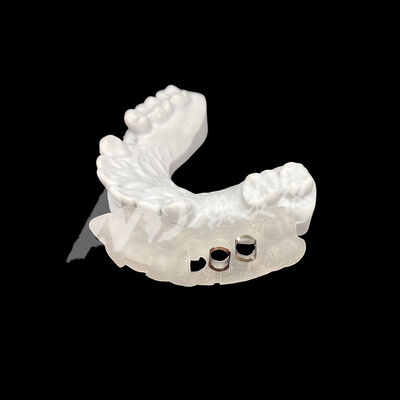 Buon prezzo Guida per impianti chirurgici stampata in 3D su misura precisa con elevata resistenza allo scolorimento utilizzando la tecnologia di fresatura CAD/CAM in linea