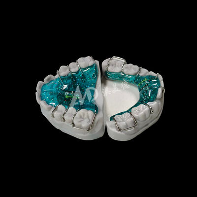 Buon prezzo Dispositivi ortodontici a espansione regolabile Dispositivi rimovibili su misura che forniscono soluzioni di allineamento dei denti confortevoli In linea