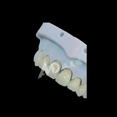 Buon prezzo Corona dentale in zirconio monolitico a contorno pieno In linea